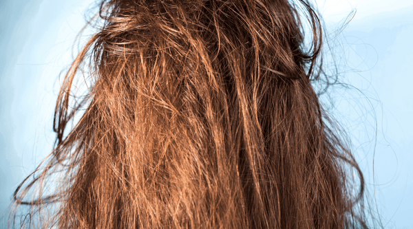 Pourquoi j'ai les cheveux gras et que faire ? - nuoo